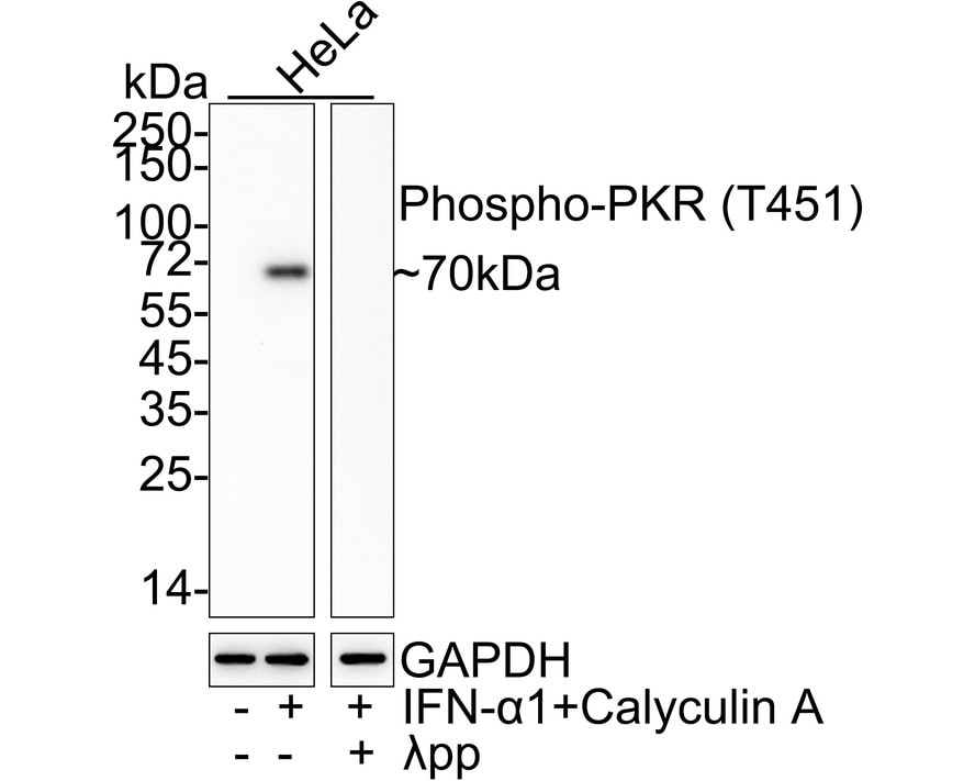 PKR [p Thr451] Antibody (JE46-70) Western Blot: PKR [p Thr451] Antibody (JE46-70) [NBP3-32789]