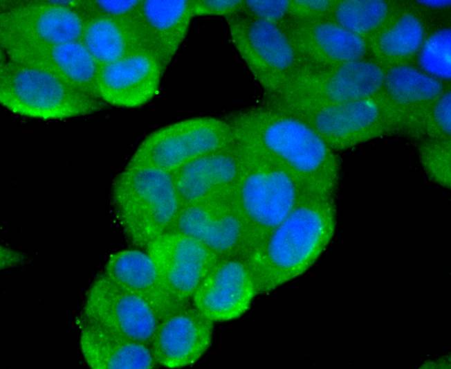 PTEN [p Ser380] Antibody (JJ08-81)