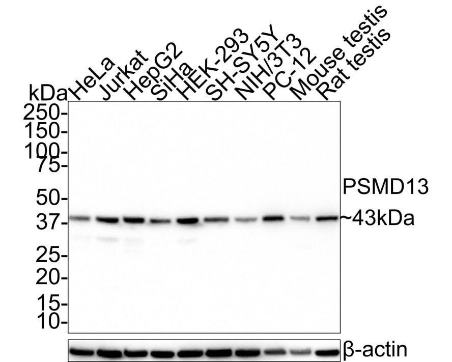 PSMD13 Antibody (PSH0-52)