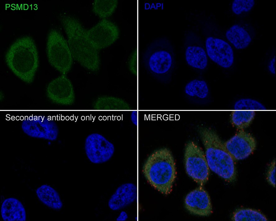 PSMD13 Antibody (PSH0-52)