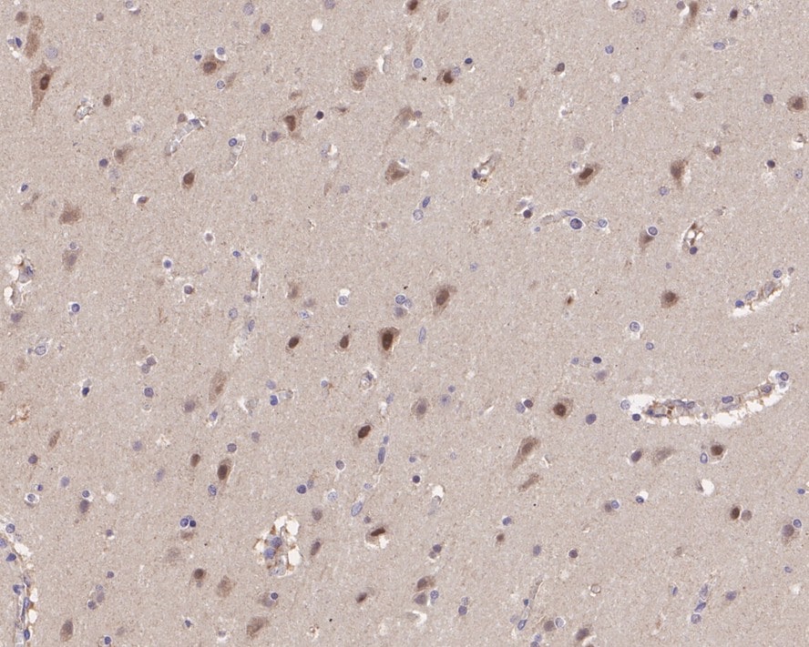 PSMD13 Antibody (PSH0-52)