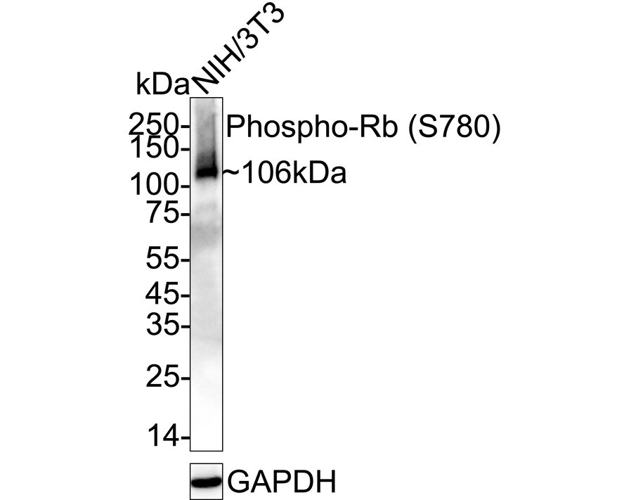RB1 [p Ser780] Antibody (JE44-61) Western Blot: RB1 [p Ser780] Antibody (JE44-61) [NBP3-32794]
