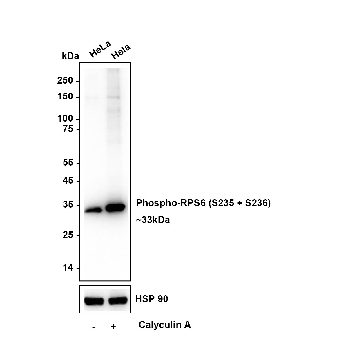Ribosomal Protein S6/RPS6 [p Ser235, p Ser236] Antibody (PS01-04) Western Blot: Ribosomal Protein S6/RPS6 [p Ser235, p Ser236] Antibody (PS01-04) [NBP3-32796]