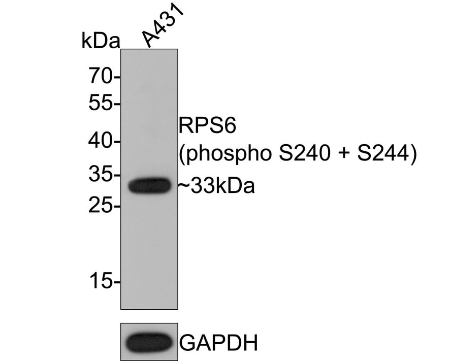 Ribosomal Protein S6/RPS6 [p Ser240, p Ser244] Antibody (PS00-65)