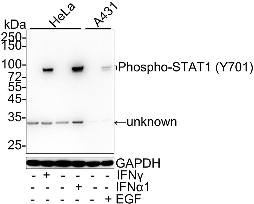 STAT1 [p Tyr701] Antibody (PSH04-02)