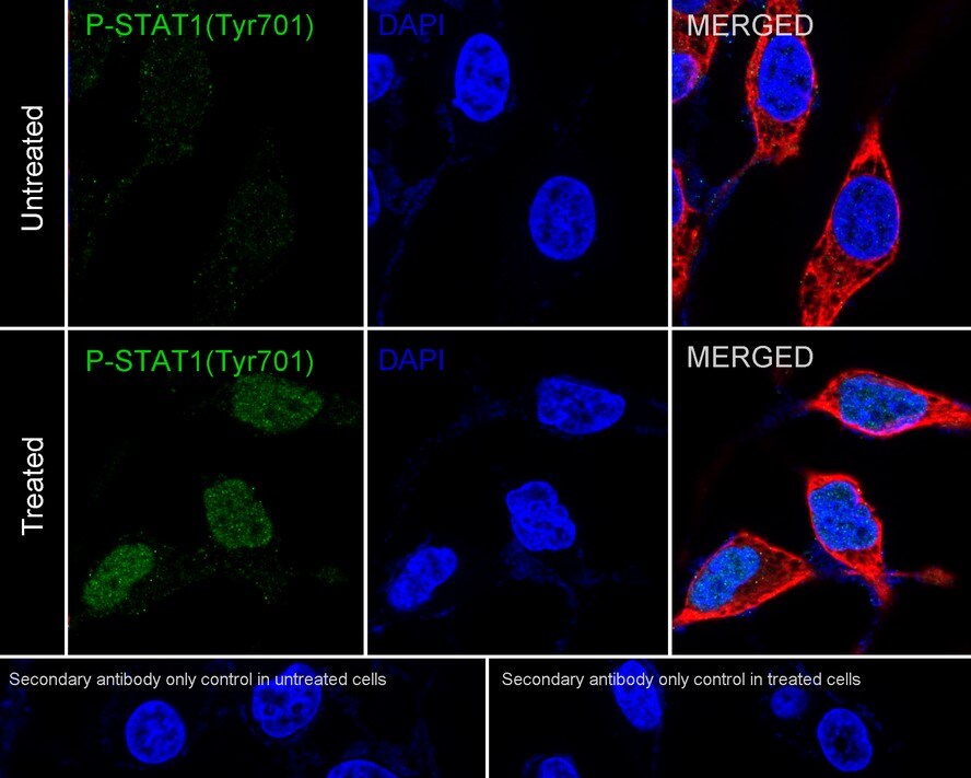 STAT1 [p Tyr701] Antibody (PSH04-02)
