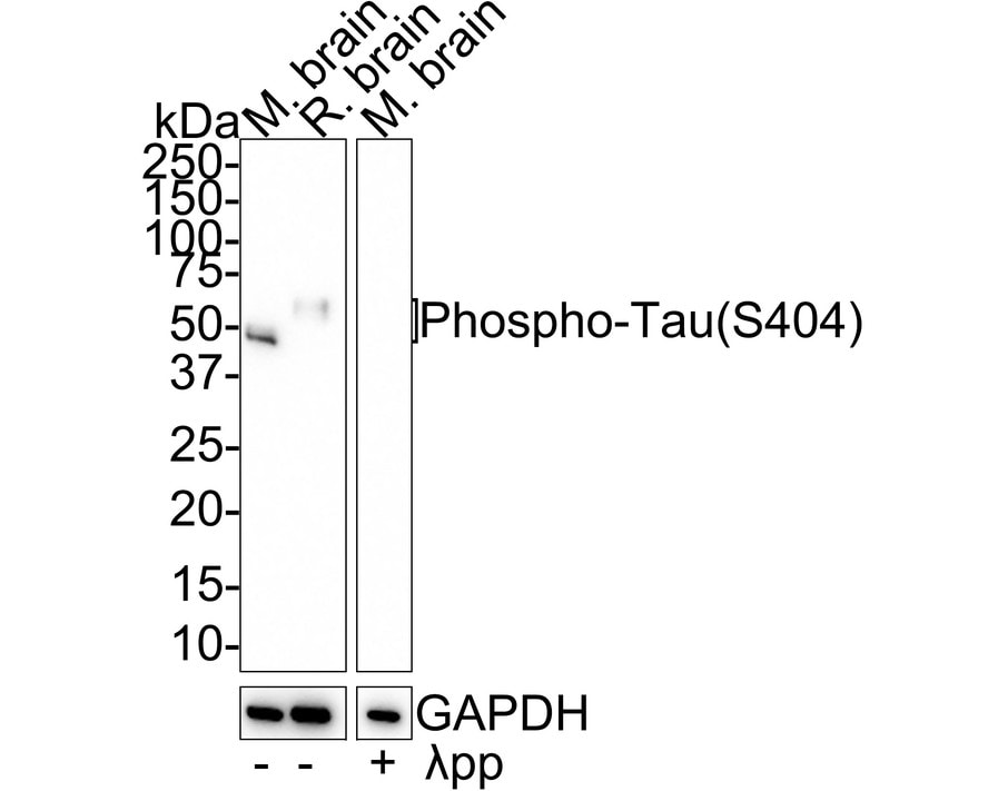 Tau [p Ser404] Antibody (JE66-82)