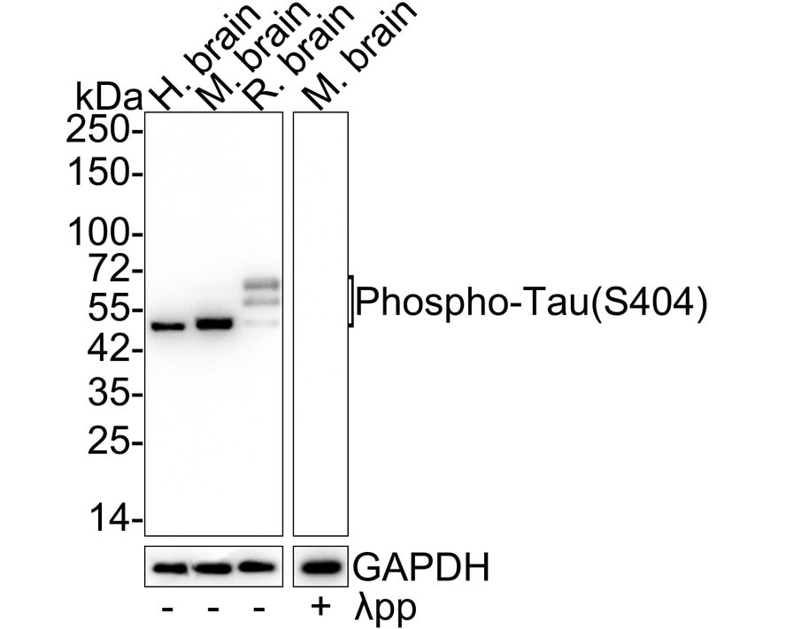 Tau [p Ser404] Antibody (JE47-88)