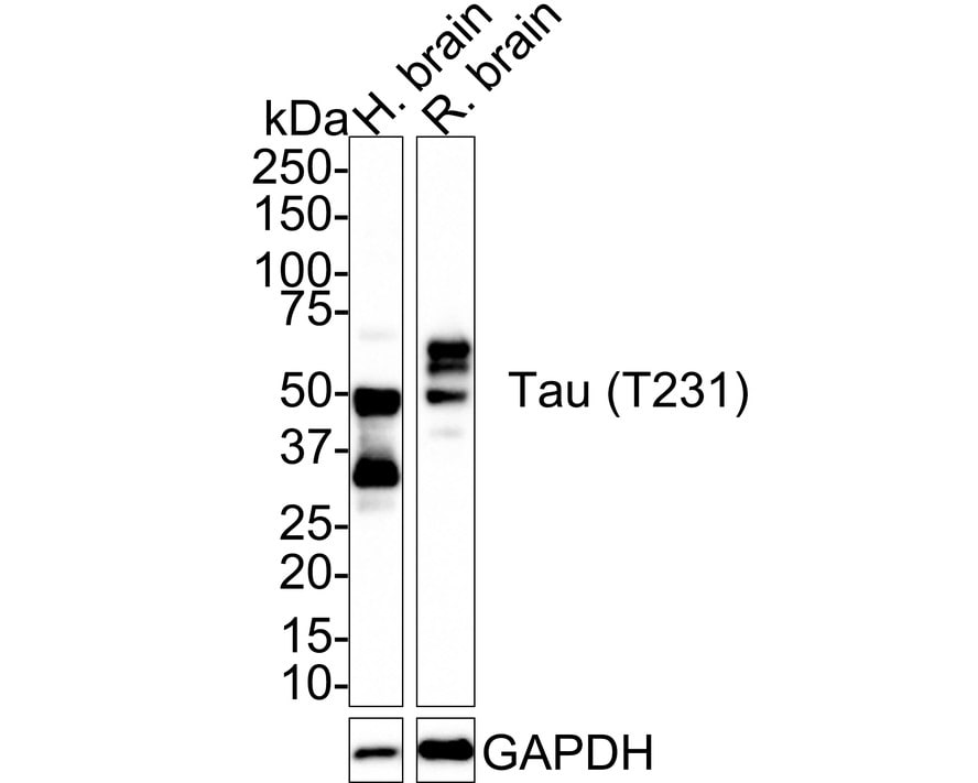 Tau [p Thr231] Antibody (PSH01-05) Western Blot: Tau [p Thr231] Antibody (PSH01-05) [NBP3-32810]