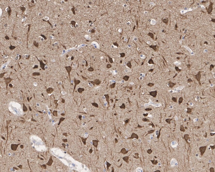 Tau [p Thr231] Antibody (PSH01-05)