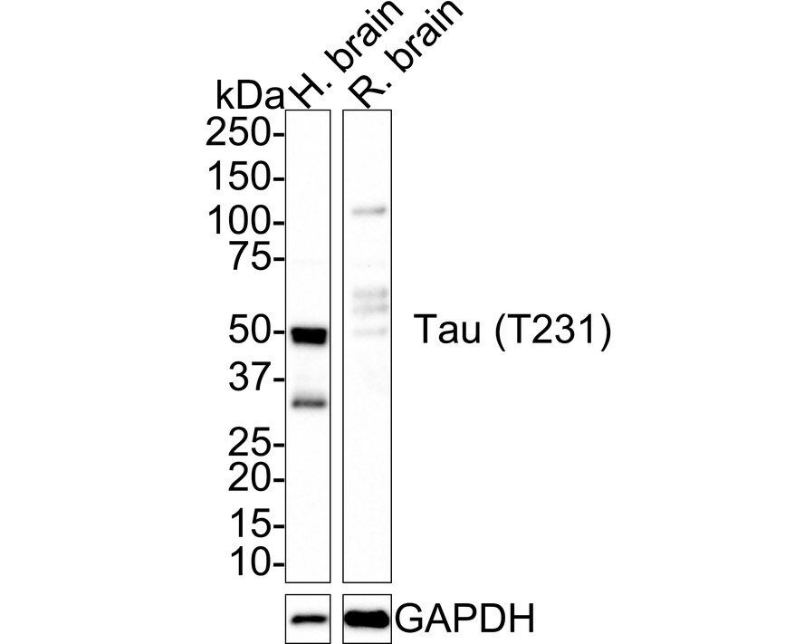 Tau [p Thr231] Antibody (PSH01-04)