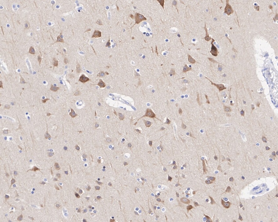 Tau [p Thr231] Antibody (PSH01-04)
