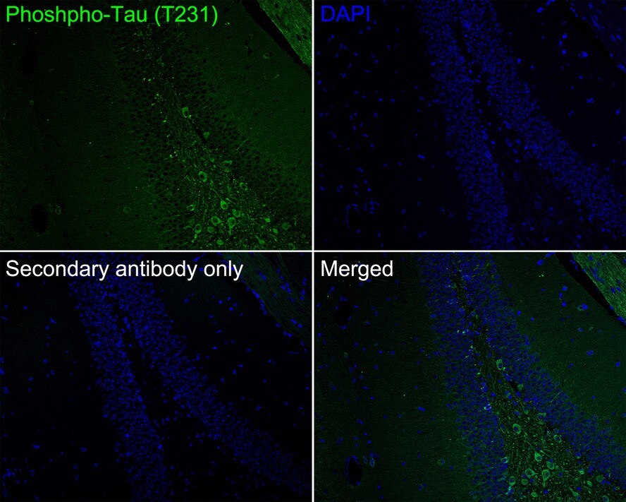 Tau [p Thr231] Antibody (PSH01-04)