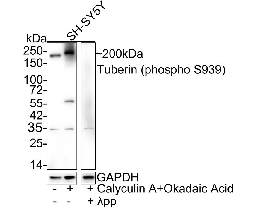 TSC2 [p Ser939] Antibody (JE54-06) Western Blot: TSC2 [p Ser939] Antibody (JE54-06) [NBP3-32812]