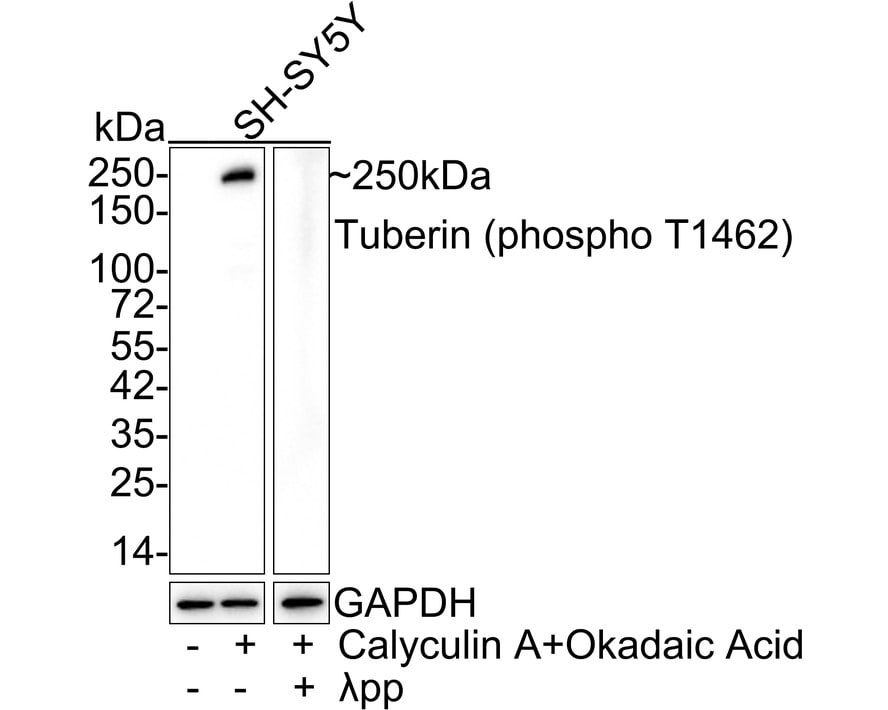 TSC2 [p Thr1462] Antibody (JE43-81) Western Blot: TSC2 [p Thr1462] Antibody (JE43-81) [NBP3-32813]