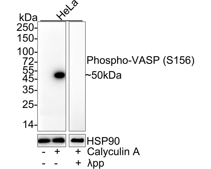 VASP [p Ser156] Antibody (JE45-91) Western Blot: VASP [p Ser156] Antibody (JE45-91) [NBP3-32815]