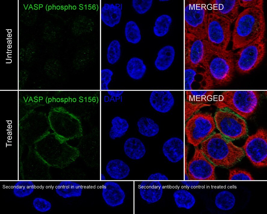 VASP [p Ser156] Antibody (JE45-91)