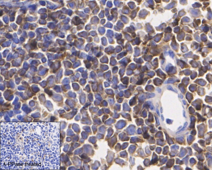VASP [p Ser156] Antibody (JE45-91)