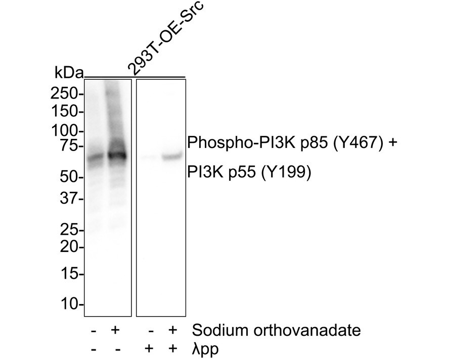 PI 3-Kinase p85 alpha [p Tyr199, p Tyr467] Antibody (PSH01-38) Western Blot: PI 3-Kinase p85 alpha [p Tyr199, p Tyr467] Antibody (PSH01-38) [NBP3-32818]