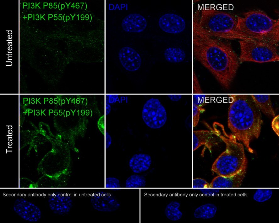 PI 3-Kinase p85 alpha [p Tyr199, p Tyr467] Antibody (PSH01-38)