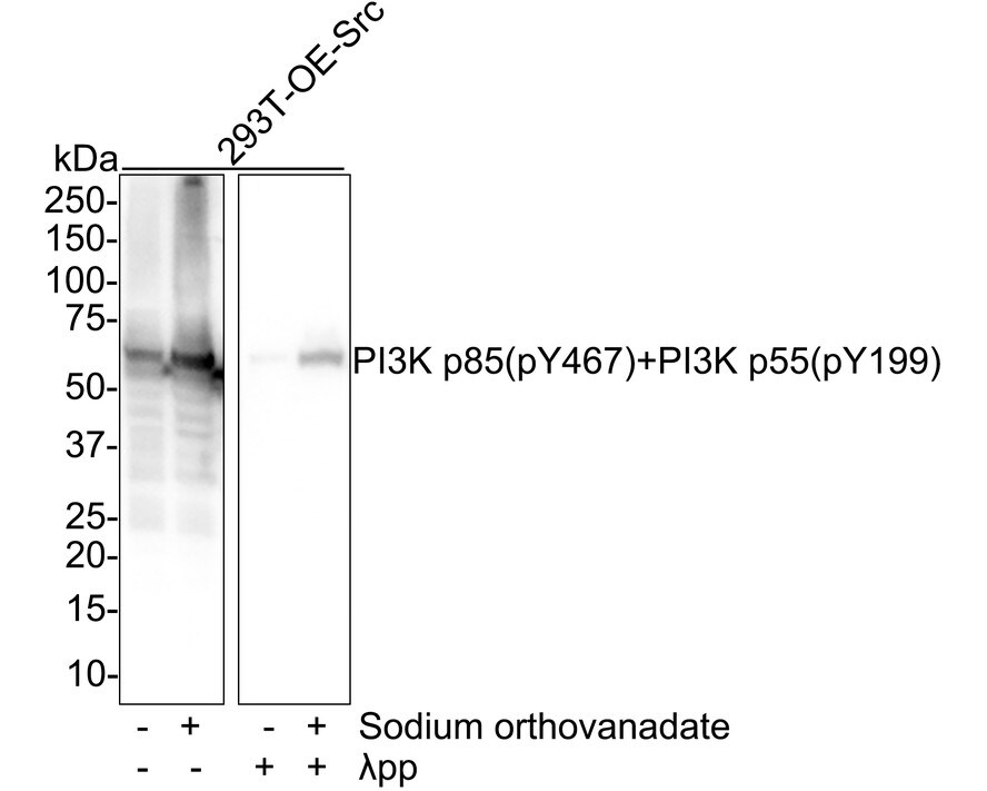 PI 3-Kinase p85 alpha [p Tyr467, p Tyr199] Antibody (PSH01-39) Western Blot: PI 3-Kinase p85 alpha [p Tyr467, p Tyr199] Antibody (PSH01-39) [NBP3-32819]