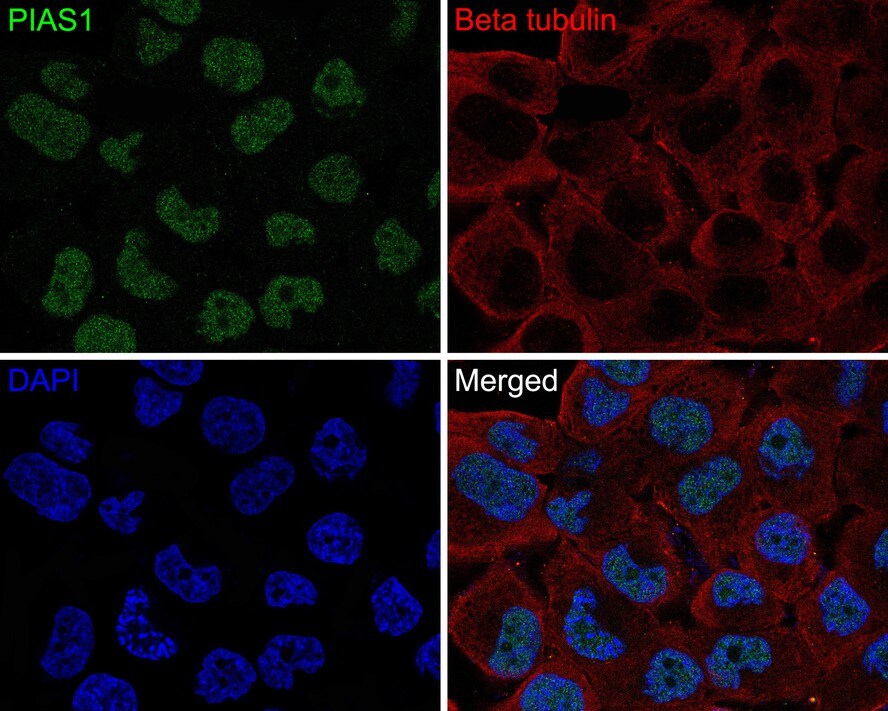 PIAS3 Antibody (JE30-36)