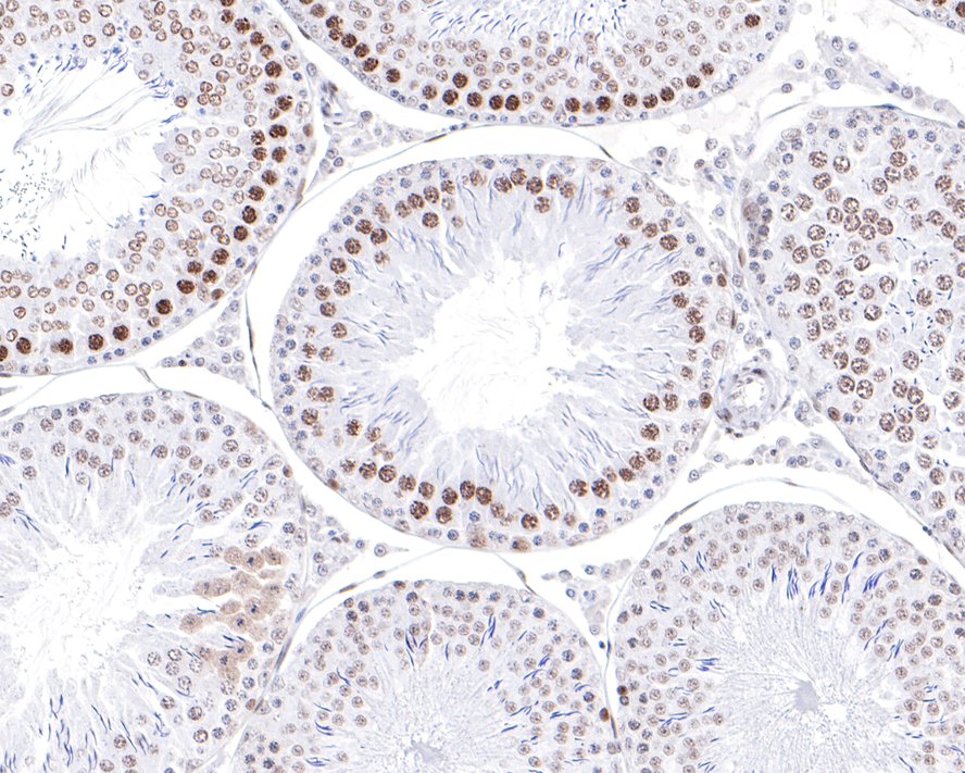 PIAS3 Antibody (JE30-36)