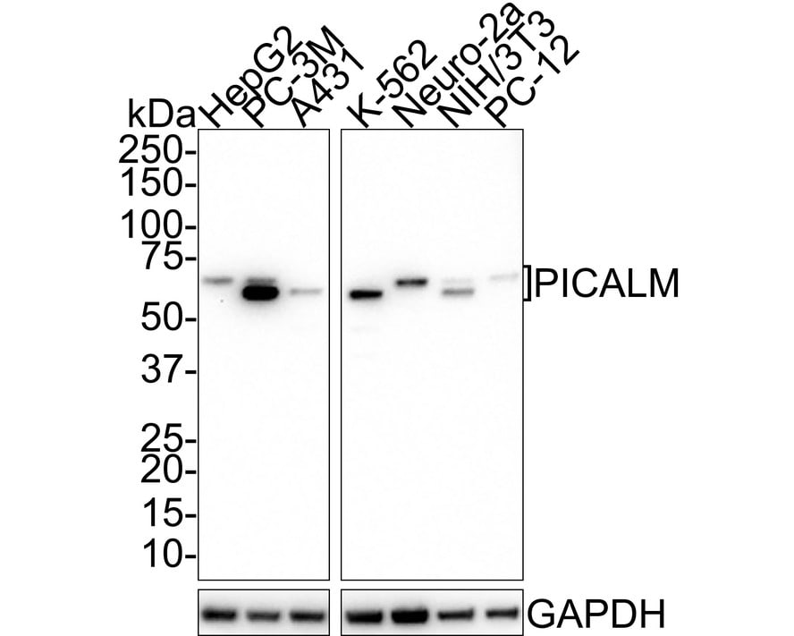 PICALM Antibody (PSH01-63) Western Blot: PICALM Antibody (PSH01-63) [NBP3-32821]