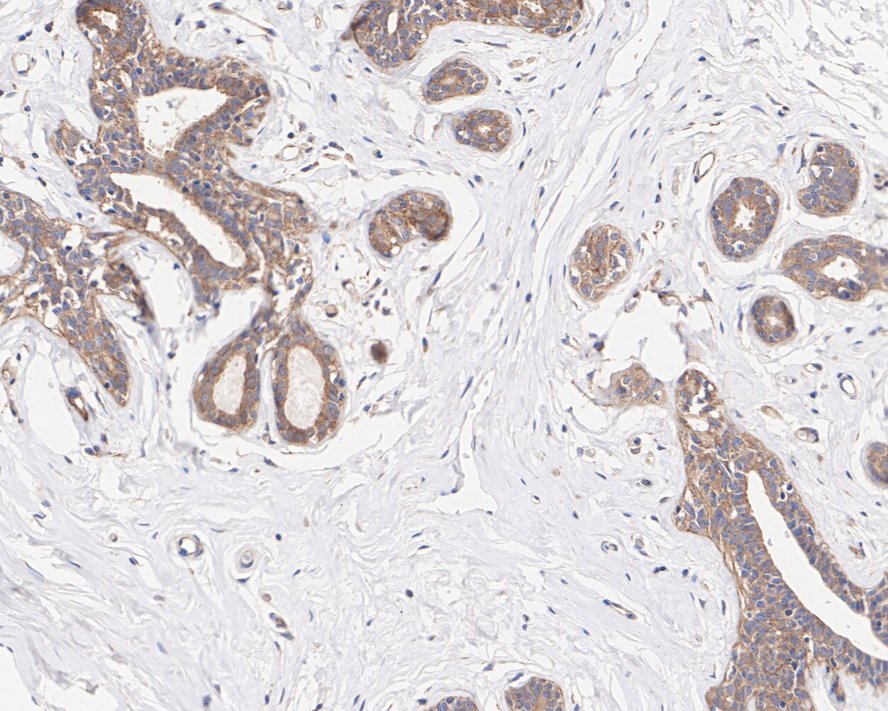PICALM Antibody (PSH01-63)