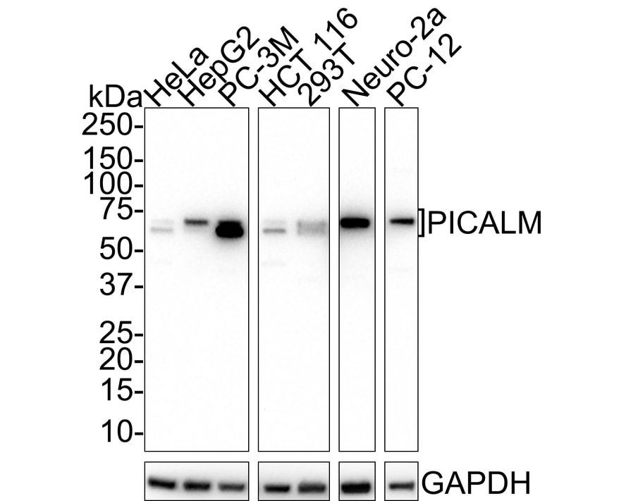 PICALM Antibody (PSH01-64) Western Blot: PICALM Antibody (PSH01-64) [NBP3-32822]