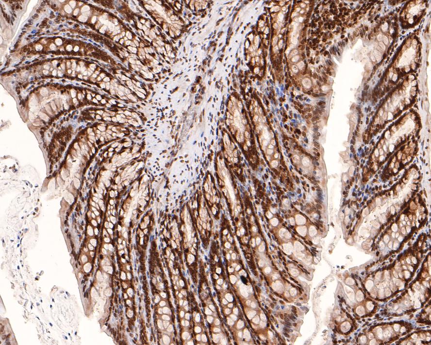PIN4 Antibody (JE64-05)