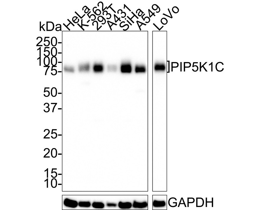 PIP5K1C Antibody (PSH01-43) Western Blot: PIP5K1C Antibody (PSH01-43) [NBP3-32824]
