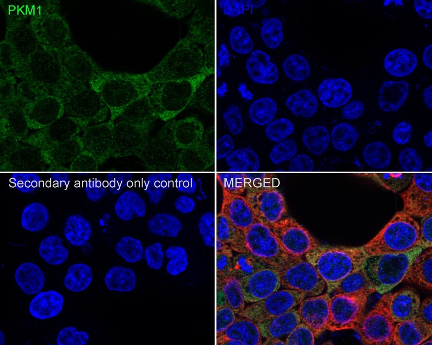 PKM1 Antibody (PSH04-37)