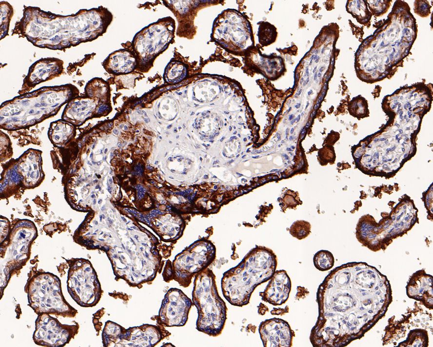 Alkaline Phosphatase/ALPP Antibody (PD00-19)