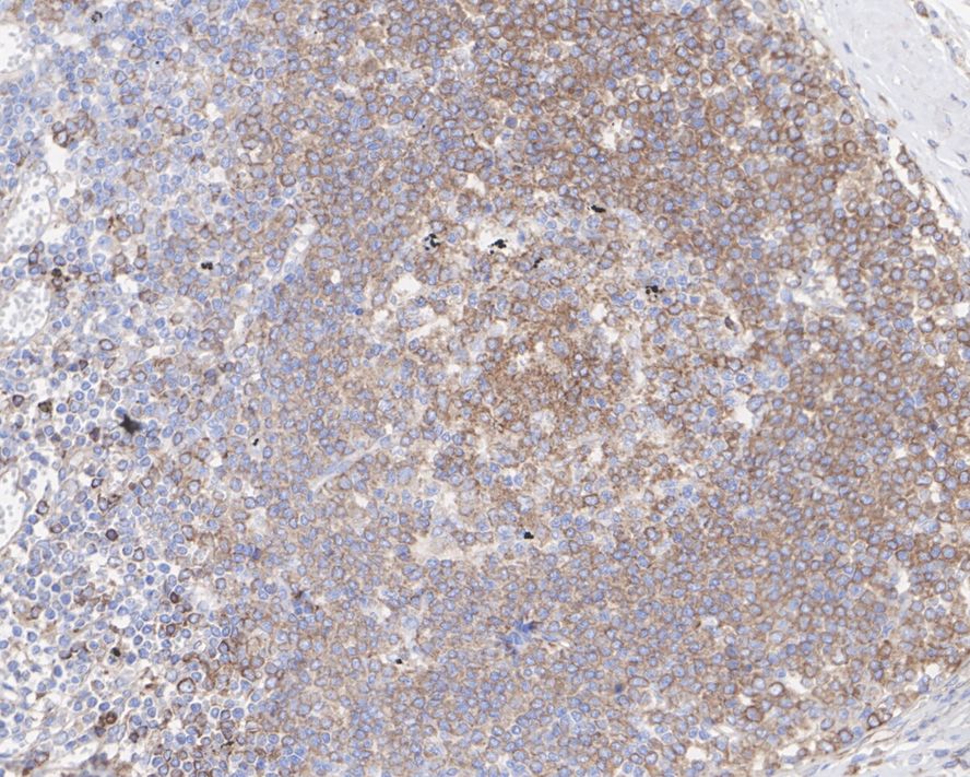 PLC-gamma 2 Antibody (JE39-12)