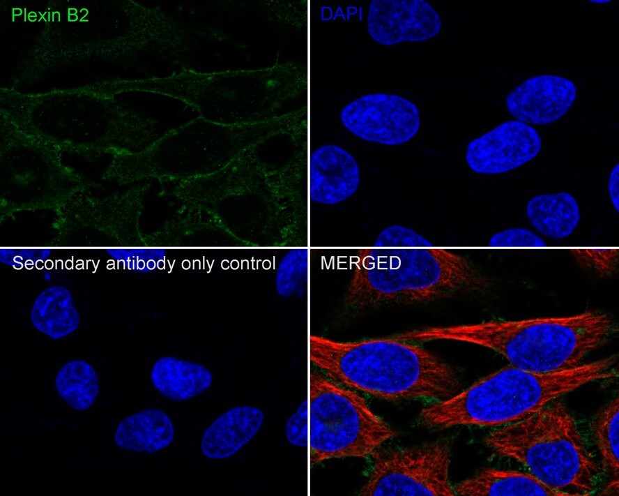 Plexin B2 Antibody (PSH03-48)
