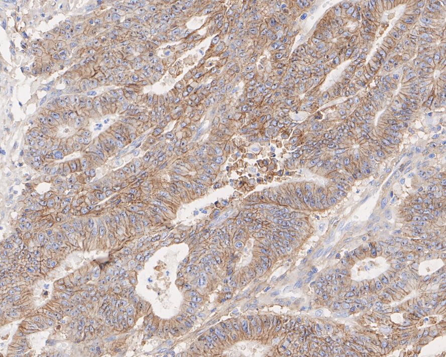 Plexin B2 Antibody (PSH03-48)