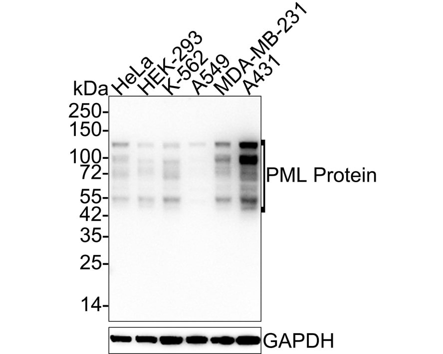 PML Protein Antibody (PSH02-68) Western Blot: PML Protein Antibody (PSH02-68) [NBP3-32831]