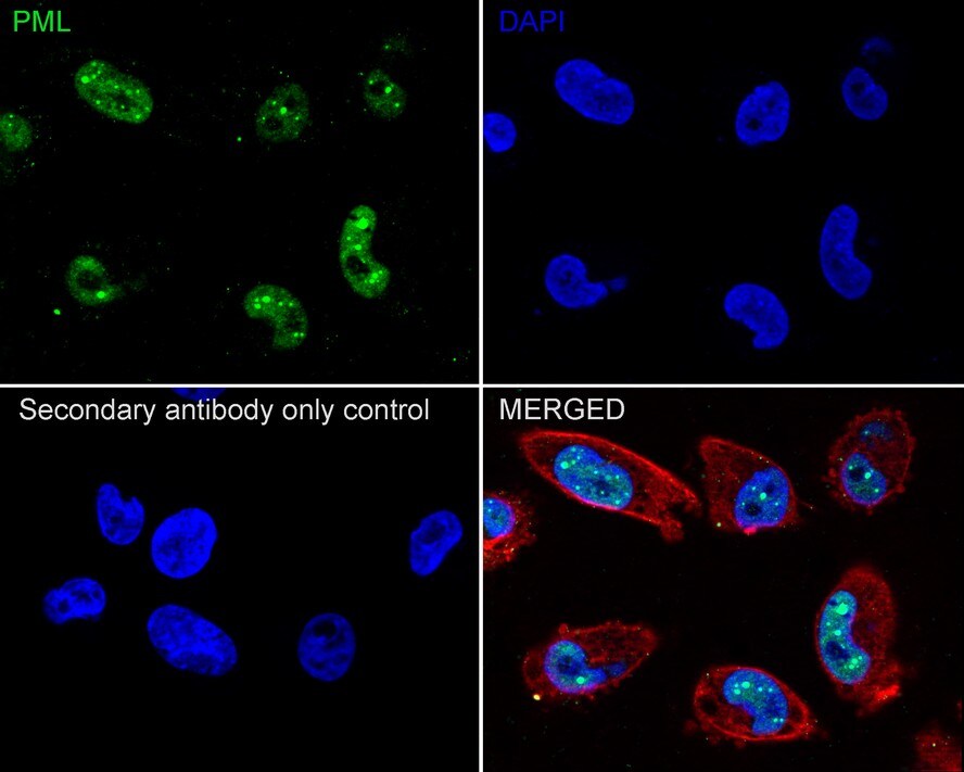 PML Protein Antibody (PSH02-68)