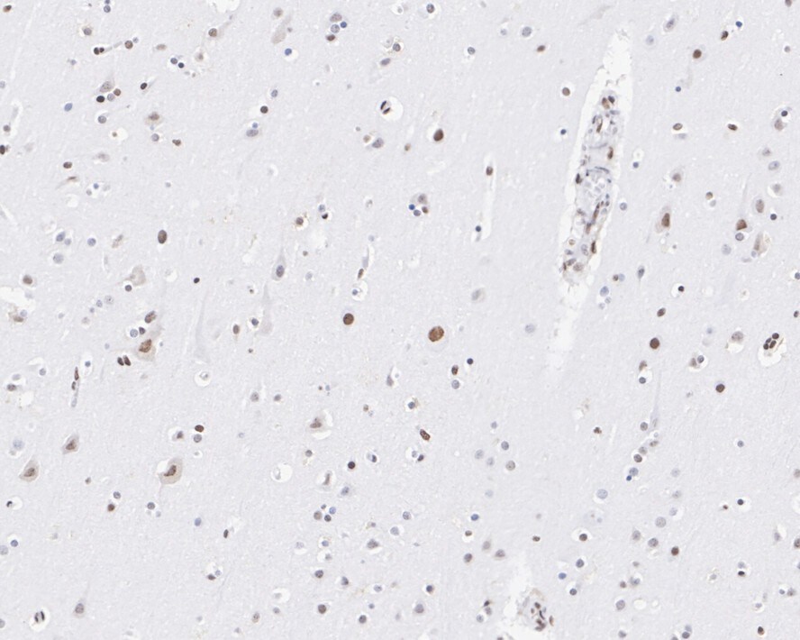 PML Protein Antibody (PSH02-68)