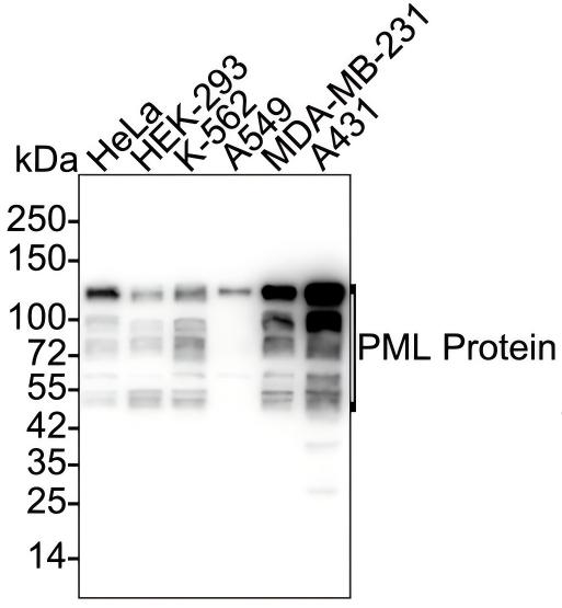 PML Protein Antibody (PSH02-89) Western Blot: PML Protein Antibody (PSH02-89) [NBP3-32832]