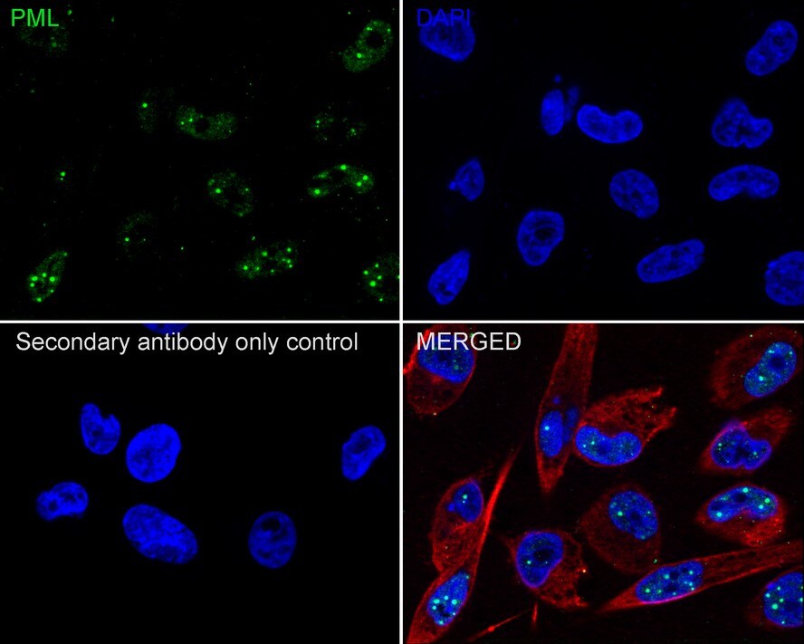 PML Protein Antibody (PSH02-89)