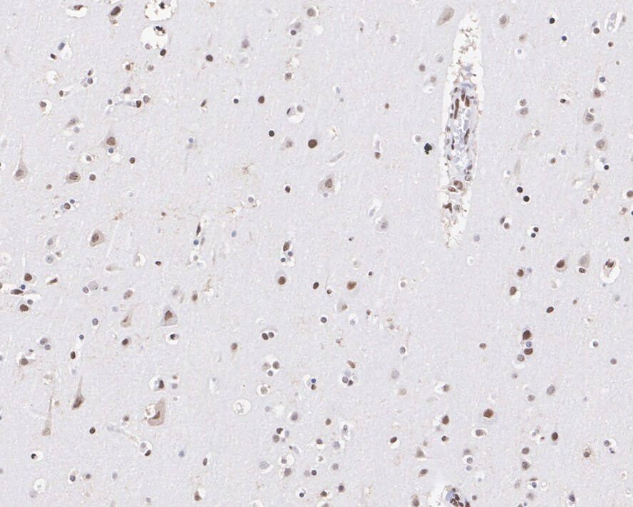 PML Protein Antibody (PSH02-89)