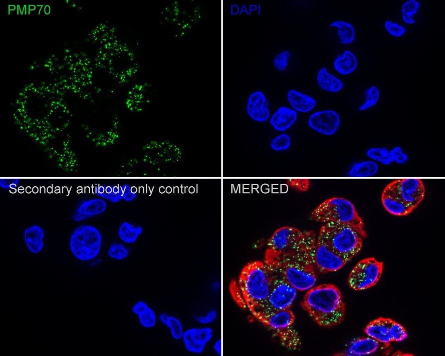 PMP70 Antibody (PSH03-27)