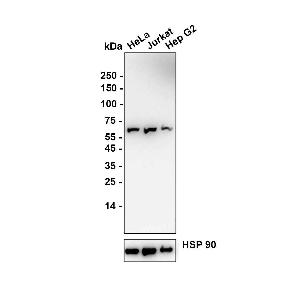 PNK Antibody (JE64-21) Western Blot: PNK Antibody (JE64-21) [NBP3-32835]