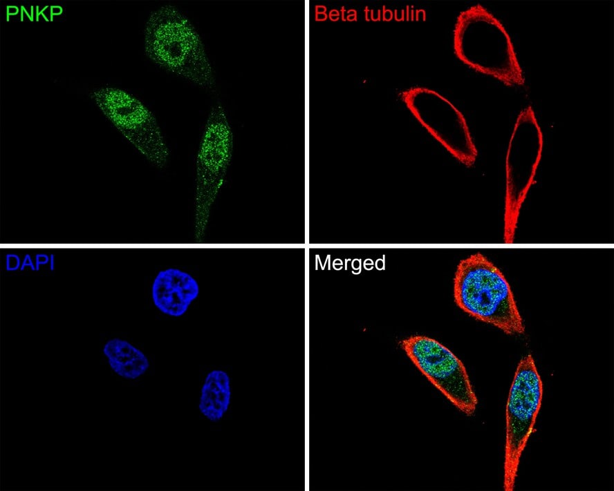 PNK Antibody (JE64-21)