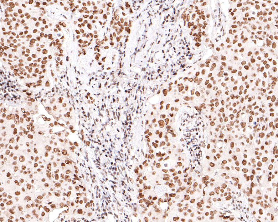 PNK Antibody (JE64-21)