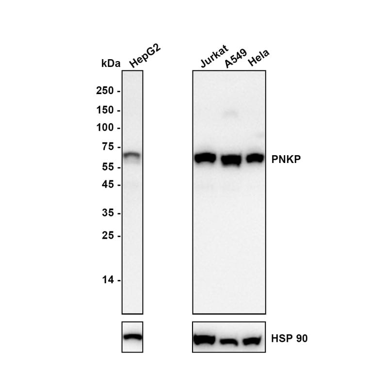 PNK Antibody (JE64-85) Western Blot: PNK Antibody (JE64-85) [NBP3-32836]