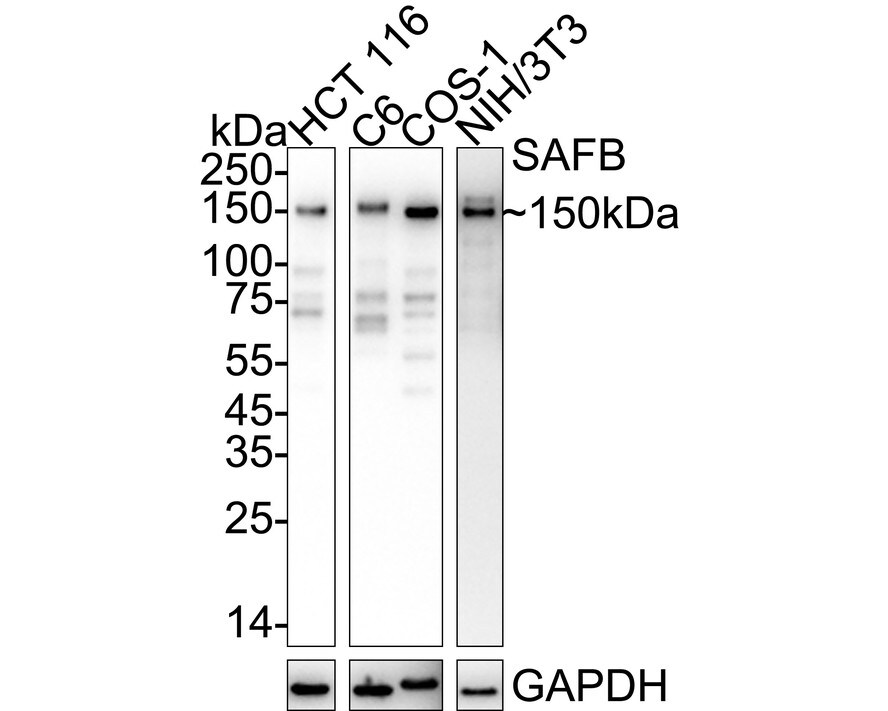 SAFB Antibody (JE64-94) Western Blot: SAFB Antibody (JE64-94) [NBP3-32837]