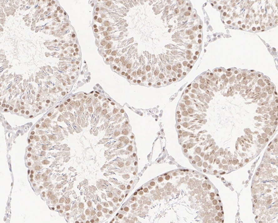 DNA Polymerase delta, catalytic subunit Antibody (JE35-73)